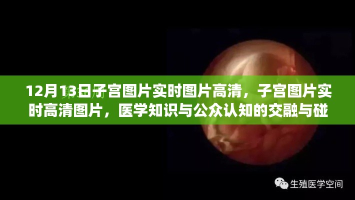 醫(yī)學知識與公眾認知交融，高清子宮圖片實時展示與探討