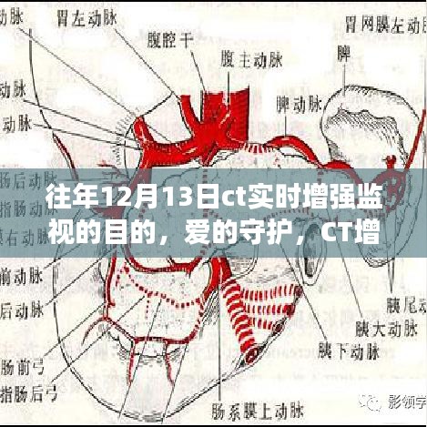 愛的守護，CT增強監(jiān)視下的暖心故事與實時增強監(jiān)視目的揭秘