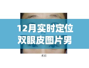 雙眼皮蛻變之旅，從學(xué)習(xí)到自信的華麗轉(zhuǎn)身，實(shí)時(shí)定位雙眼皮圖片男展示十二月的蛻變歷程
