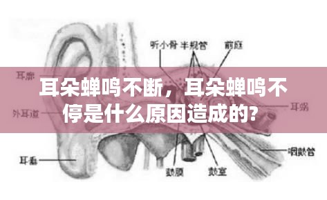 耳朵蟬鳴不斷，耳朵蟬鳴不停是什么原因造成的? 