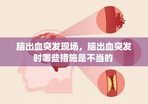 腦出血突發(fā)現(xiàn)場，腦出血突發(fā)時哪些措施是不當(dāng)?shù)?