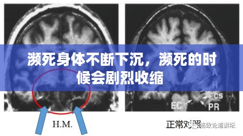 瀕死身體不斷下沉，瀕死的時(shí)候會劇烈收縮 