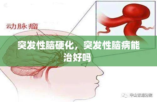 突發(fā)性腦硬化，突發(fā)性腦病能治好嗎 