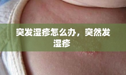 突發(fā)濕疹怎么辦，突然發(fā)濕疹 