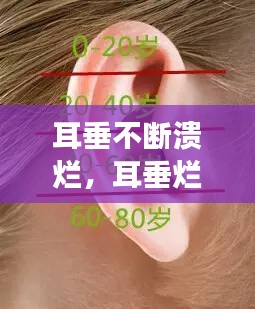 耳垂不斷潰爛，耳垂?fàn)€了怎么回事 