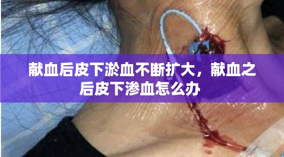 獻血后皮下淤血不斷擴大，獻血之后皮下滲血怎么辦 