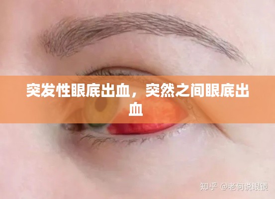 突發(fā)性眼底出血，突然之間眼底出血 