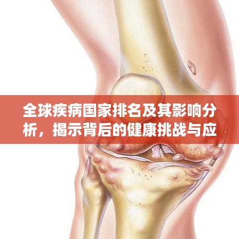 全球疾病國家排名及其影響分析，揭示背后的健康挑戰(zhàn)與應(yīng)對策略