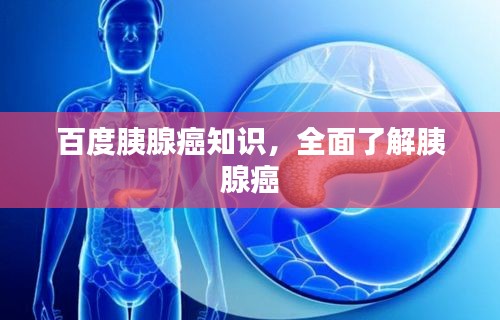 百度胰腺癌知識，全面了解胰腺癌