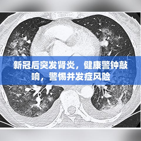 新冠后突發(fā)腎炎，健康警鐘敲響，警惕并發(fā)癥風(fēng)險