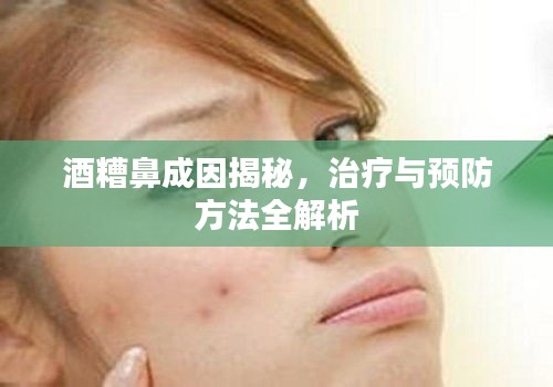 酒糟鼻成因揭秘，治療與預防方法全解析